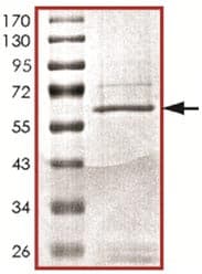 Recombinant Human Bub1 protein(AB127642)