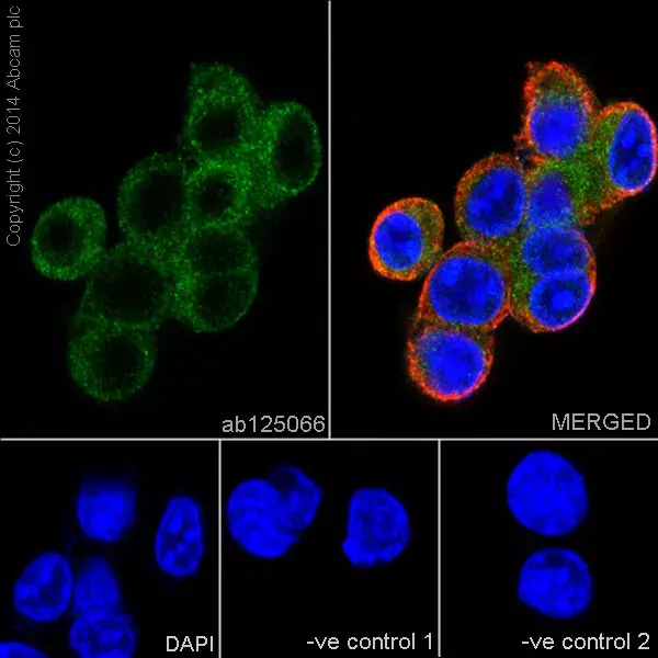 Anti-Glutathione Peroxidase 4 antibody [EPNCIR144](AB125066)