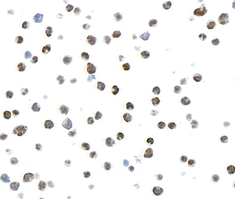 Anti-TOX antibody [BLR212K] - BSA free(AB314043)