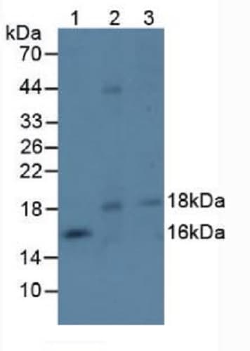 Ephrin A4 Antibody Ab232711  Western Blot Img104876