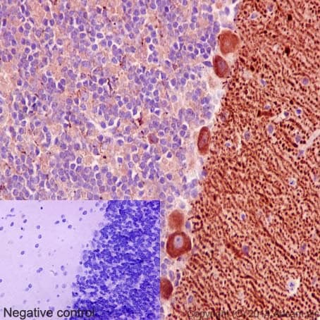 Anti-Niemann Pick C1 antibody [EPR5209] - BSA and Azide free(AB224268)