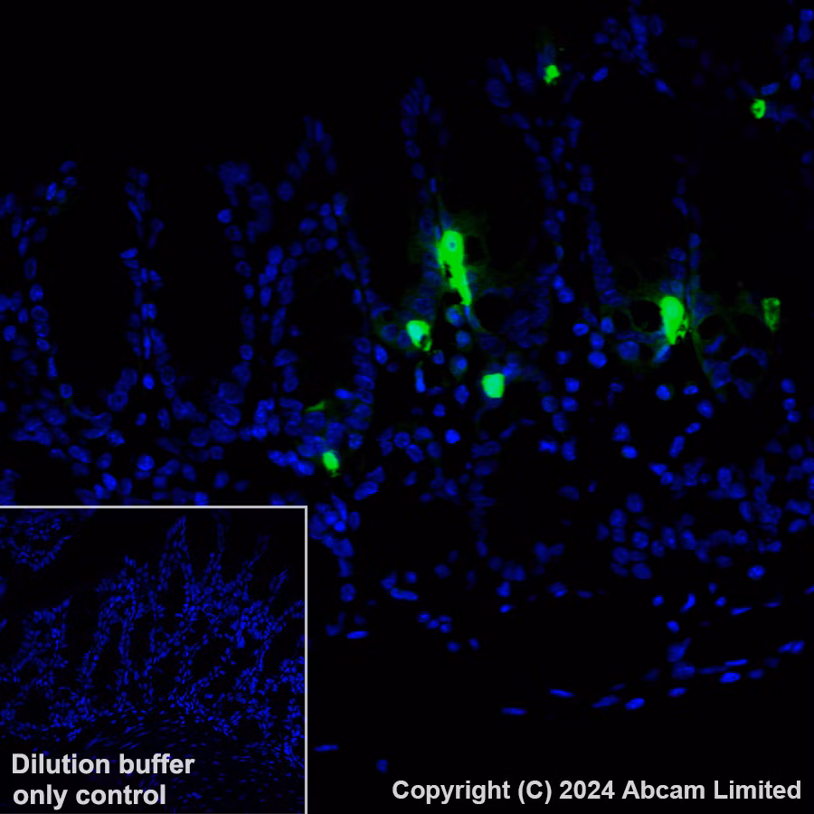 Alexa Fluor 488 Serotonin Antibody Epr24431 201 Ab321853 Immunohistochemistry Formalin Pfa Fixed Paraffin Embedd 3xeznBztap