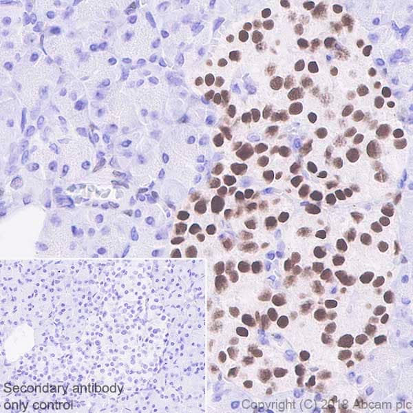 Anti-Islet 1 antibody [EPR10362](AB178400)