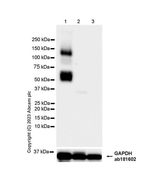 Anti-Aggrecan antibody [EPR28034-86](AB313636)