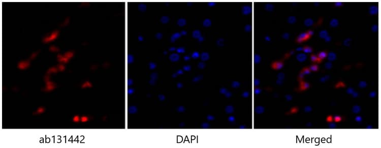 Anti-p53 antibody(AB131442)