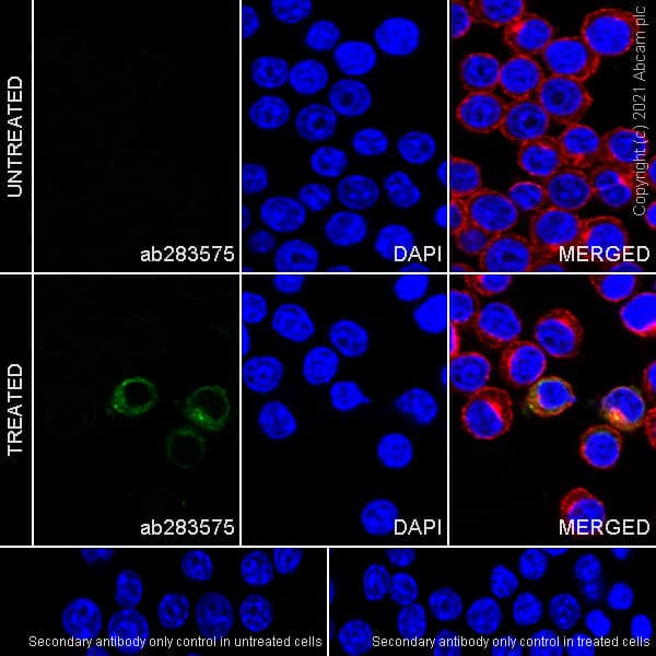 Anti-MMP9 antibody [RM1020](AB283575)