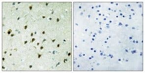 Mxd4 Mad4 Antibody Ab111062  Immunohistochemistry Formalin Pfa Fixed Paraffin Embedded Sections Img23534