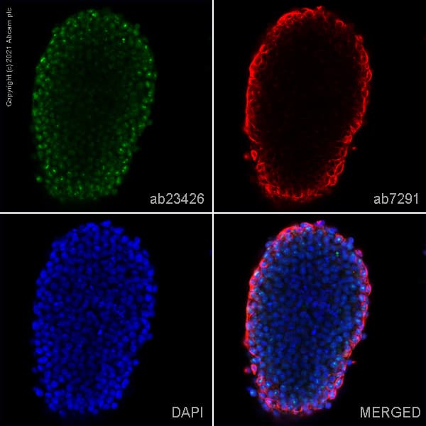 Anti-NOTCH3 antibody(AB23426)