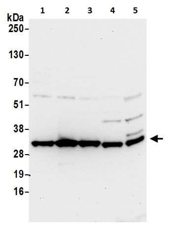 Anti-HPRT antibody(ab226412)