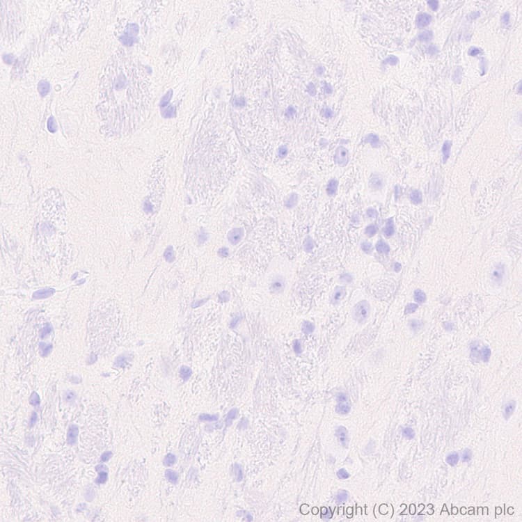 Anti-Neutrophil Elastase antibody [RM1077](AB314916)