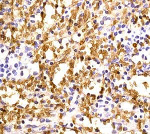 Hemoglobin Subunit Beta Hemoglobin Subunit Delta Antibody Epr8322b Ab131225  Immunohistochemistry Formalin Pfa Fixed Paraffin Embedded Sections Img114801