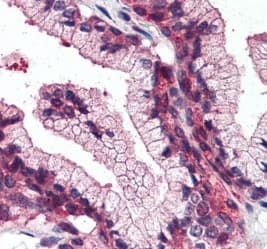 Anti-SLC39A14/ZIP-14 antibody(AB219174)