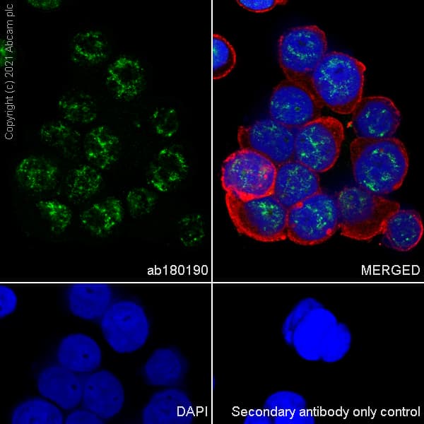 Ddx17 Antibody Epr13807b Ab180190  Immunocytochemistry Immunofluorescence Img167745