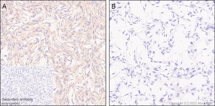 Anti-TRIM21/SS-A antibody [EPR20290](AB207728)