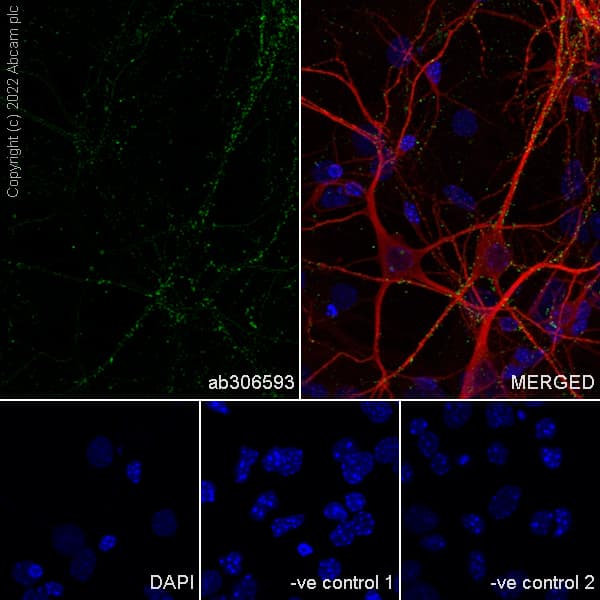Anti-Bassoon/BSN antibody [L124-59](AB306593)