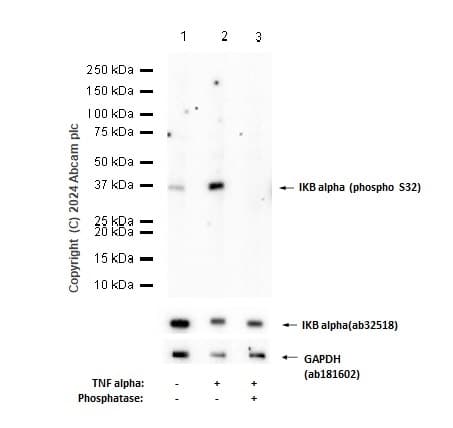 Anti-IKB alpha antibody [E130](AB32518)
