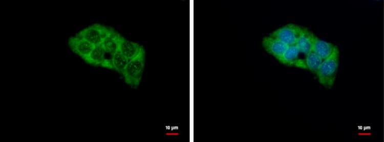 Rpl4 Antibody Ab154907  Immunocytochemistry Img13157