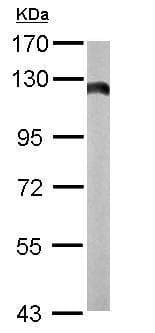 Anti-Hexokinase II antibody(AB227198)