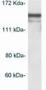 Hdac4 Antibody Ab16339  Western Blot Img71941