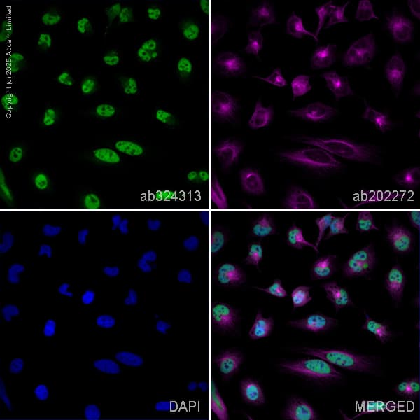 Alexa Fluor 594 Alpha Tubulin Antibody Ep1332y Microtubule Marker Ab202272  Immunocytochemistry Immunofluorescence Img447035