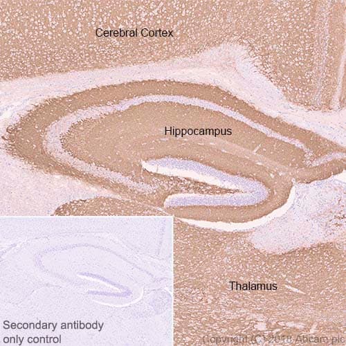 Anti-VGluT1 antibody [EPR22269](ab227805)