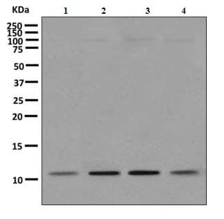 Snrpf Antibody Epr10389b Bsa And Azide Free Ab249275  Western Blot Img111249