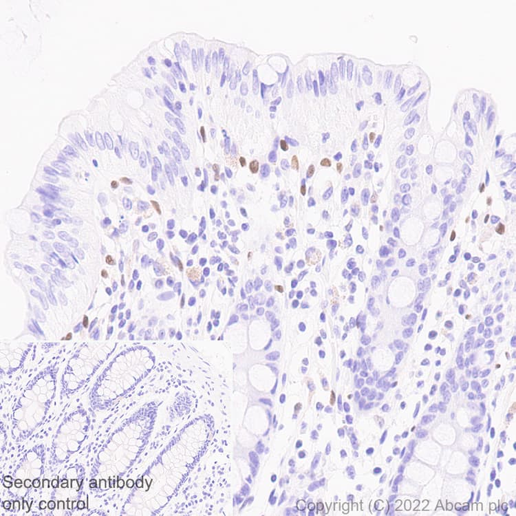 Anti-ZEB1 antibody [EPR26184-63] - BSA and Azide free(AB303481)
