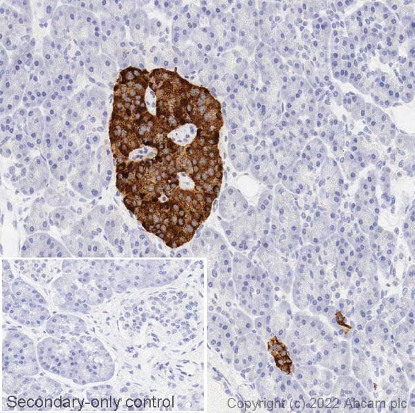 Anti-Chromogranin A antibody(AB15160)