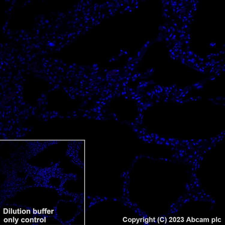 Alexa Fluor® 647 Anti-LINE-1 ORF1p antibody [EPR22227-6](AB314927)