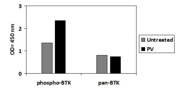 Phospho-BTK (Y551) ELISA Kit(AB279751)