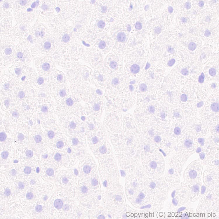 Anti-Bassoon/BSN antibody [L124-59](AB306593)
