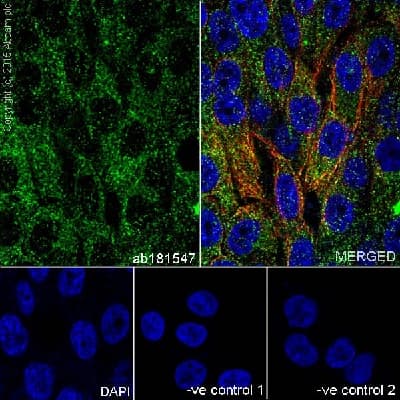 Anti-Insulin antibody [EPR17359](AB181547)