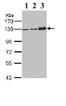 Anti-Desmoglein 2/DSG2 antibody(AB96761)