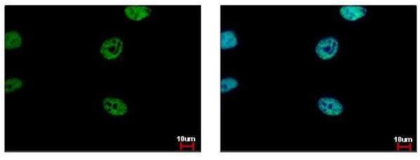 Anti-FLI1 antibody(AB153909)