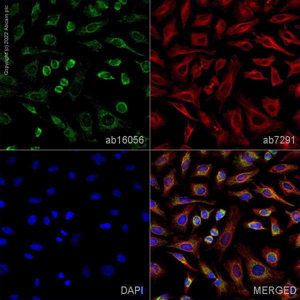 Anti-COX IV antibody - Mitochondrial Loading Control(AB16056)
