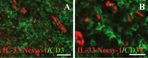 Anti-CD3 epsilon antibody [SP7] - BSA and Azide free(AB205228)