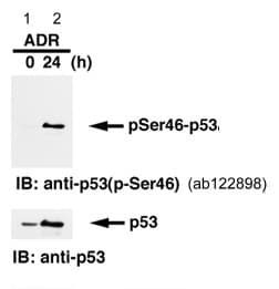 P53 Phospho S46 Antibody 36 Ab122898  Western Blot Img52024