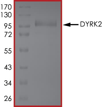 Recombinant human DYRK2 protein(AB133138)