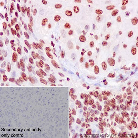 Anti-Ki67 antibody [EPR3610](AB92742)