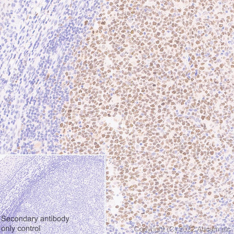 Anti-SUZ12 antibody [EPR26230-82] - BSA and Azide free(AB307892)