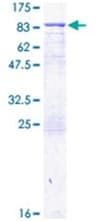 Recombinant Human Transglutaminase 2 protein(AB152748)