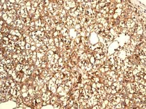 Anti-Glucose Transporter GLUT1 antibody [EPR3915] - BSA and Azide free(AB252403)