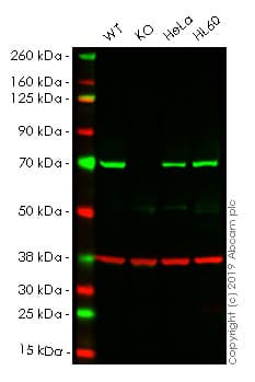Anti-Pyruvate dehydrogenase E2/E3bp antibody [13G2AE2BH5](AB110333)