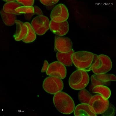 Anti-Glucose Transporter GLUT1 antibody(AB15309)