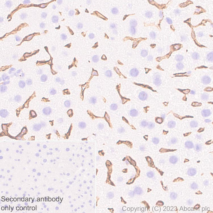 Anti-LYVE1 antibody [RM1067](AB314241)