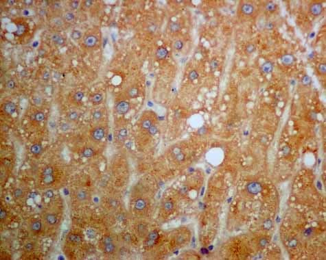 Txnrd1 Antibody Epr10205 Ab167411  Immunohistochemistry Formalin Pfa Fixed Paraffin Embedded Sections Img131927