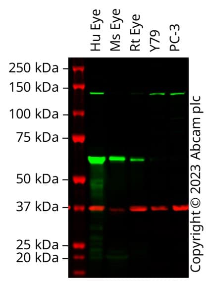 Anti-RPE65 antibody [EPR22579-44](ab231782)