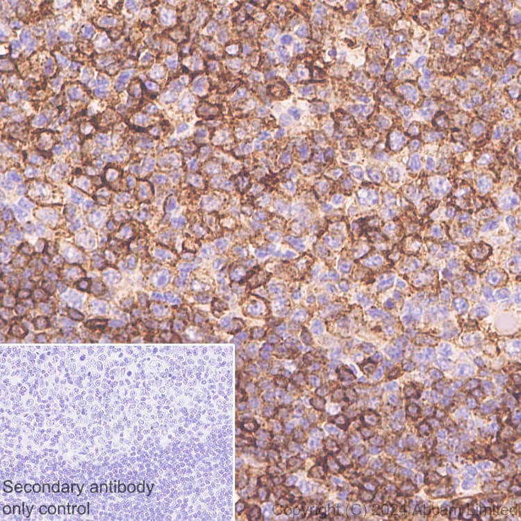 Anti-HLA DR + DP + DQ antibody [CR3/43](ab7856)
