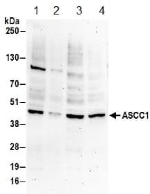 Anti-ASCC1 antibody(AB157102)