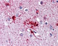 Rig I Ddx58 Antibody Ab111037  Immunohistochemistry Formalin Pfa Fixed Paraffin Embedded Sections Img72398